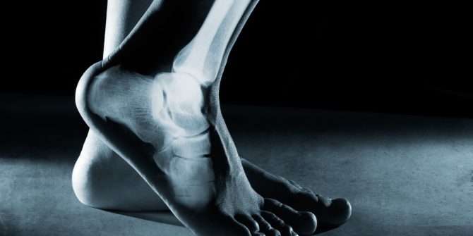 Image of Assessing and correcting foot and ankle pain